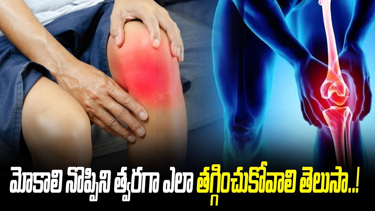 How to Relieve Knee Pain Fast | Easy Exercises & Home Remedies for Knee ...