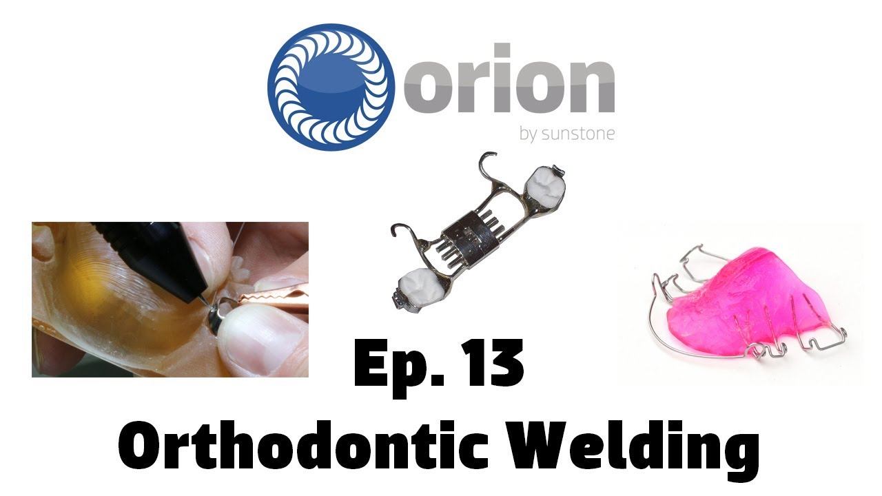 Ортодонтическая сварка — обучающий вебинар Orion — Эпизод 13