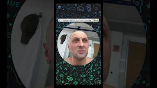 🤦🏼‍♂️ Последствия употребления беляша с автовокзала 🤣 | Зубарев #shorts