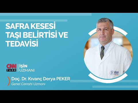 Safra Kesesi Taşı Belirtisi ve Tedavisi