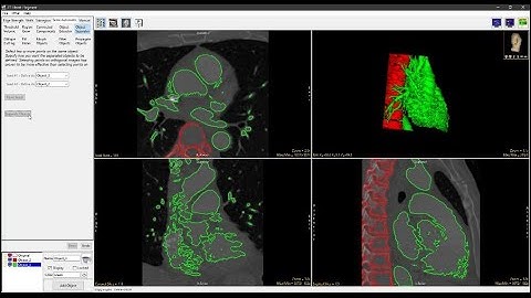 Analyze 14.0 - Segment: Object Separator