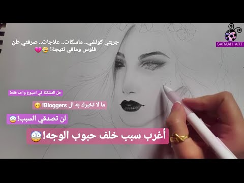بعيد عن الرسم : التخلص من حبوب الوجه في اسبوع!