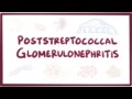 Poststreptococcal glomerulonephritis - causes, symptoms, treatment & pathology