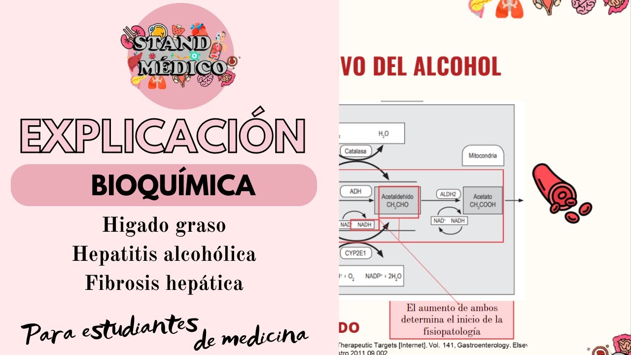 Hepatopatía ALCOHÓLICA: Todo lo que debes de saber
