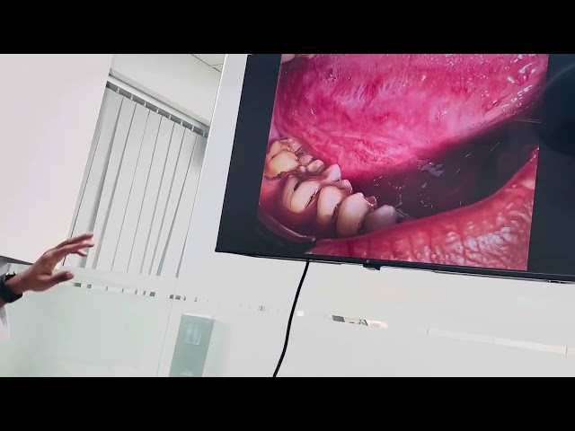 Oral Ulcer Patient’s Review | Bangladesh