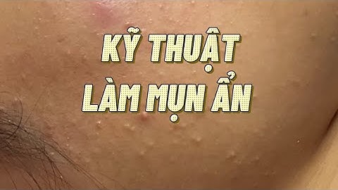 Cây nặn mụn tiếng anh là gì