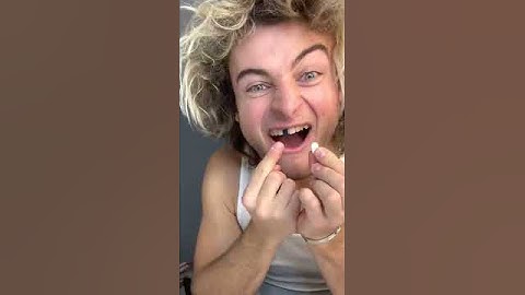 TOPPER GUILD LOSES TOOTH PRANK - #Shorts