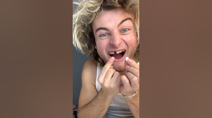 TOPPER GUILD LOSES TOOTH PRANK - #Shorts