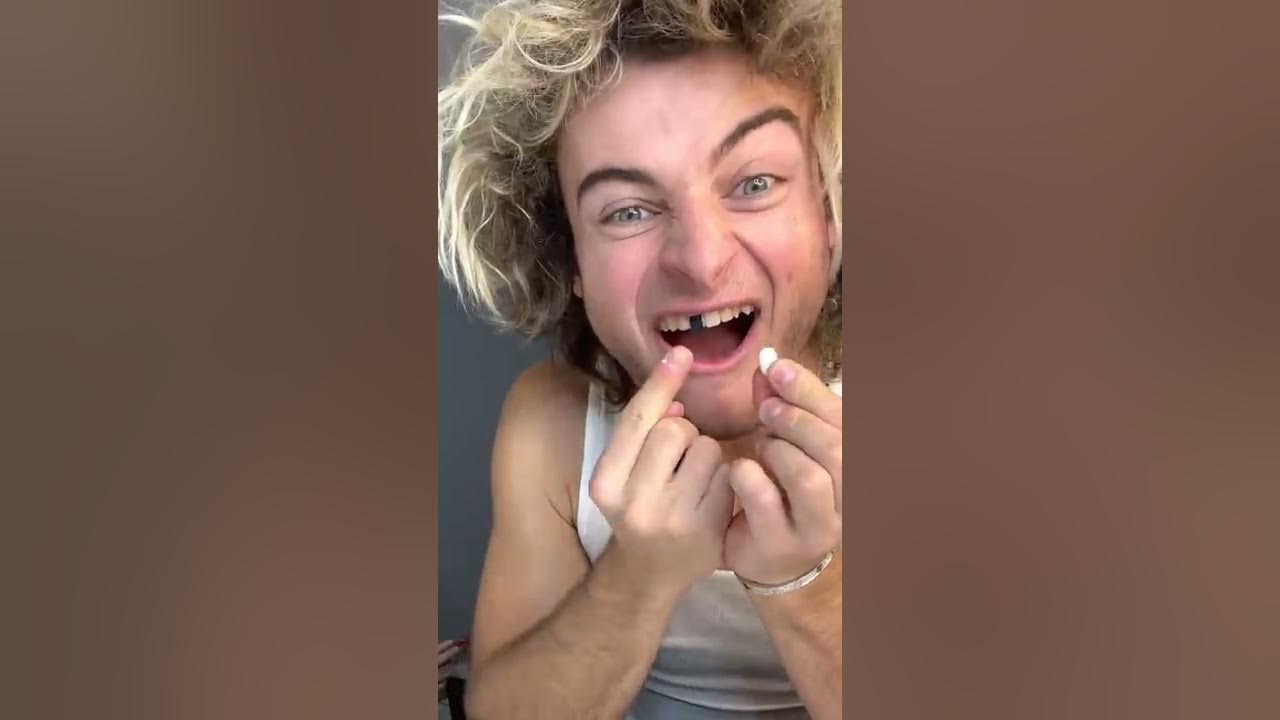 TOPPER GUILD LOSES TOOTH PRANK - #Shorts