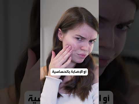 ظهور حبوب الوجه في هذه الأماكن مؤشر لمشكلة صحية كامنة