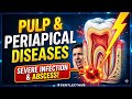 How to diagnose pulpal and periodontal diseases? #neetpreparation #dentalstudent #dentistry