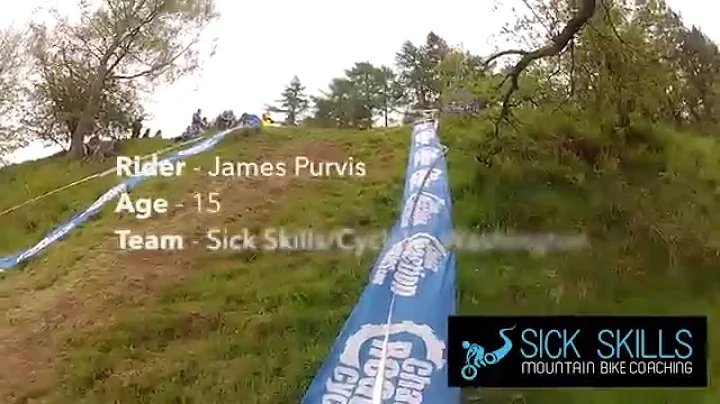 James Purvis Horrific Mountain Bike Crash