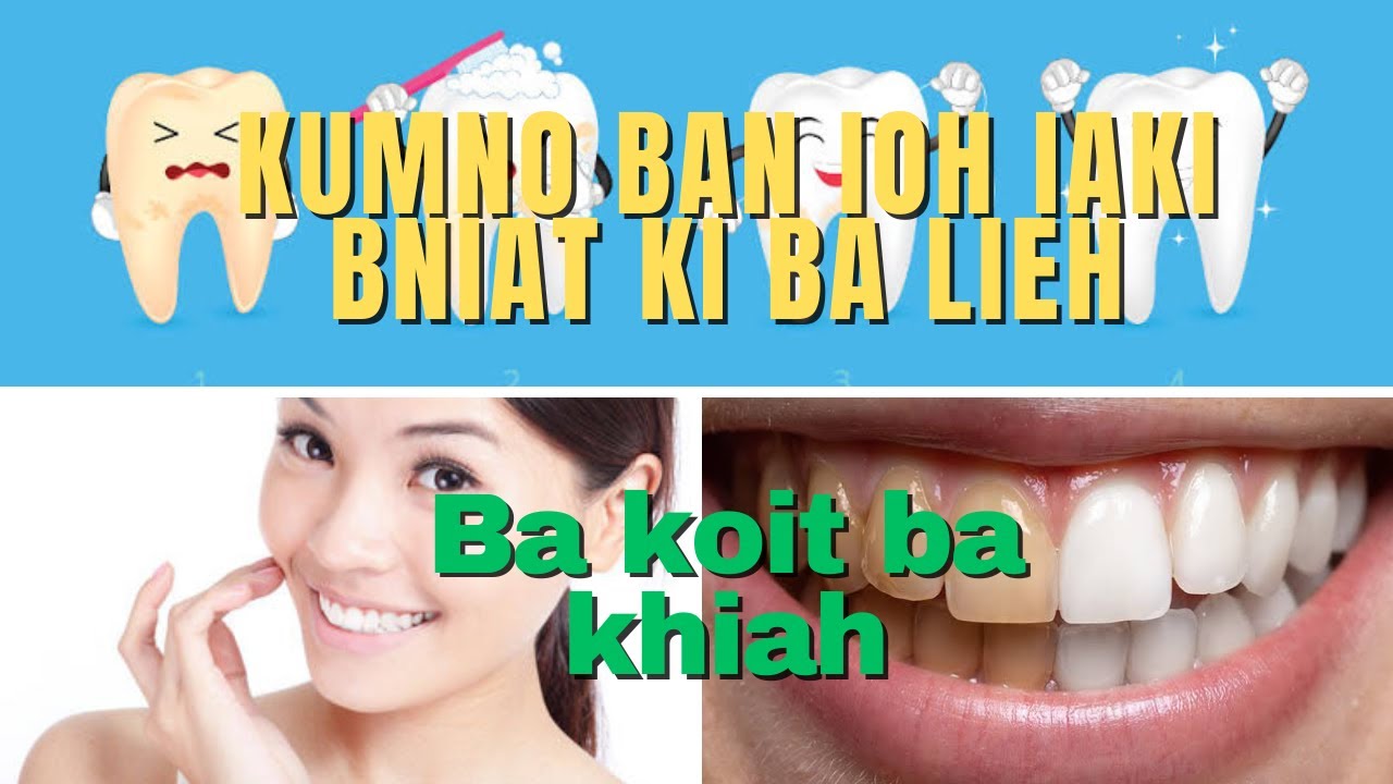 Kumno ban pynlieh ia ki bniat jong phi bad kiba koit ba khiah | Da ka ba leh hi haing