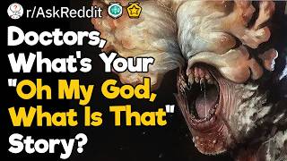 Doctors, Whats Your Oh My God, What Is That Story?