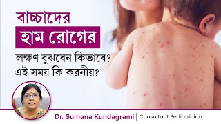 হাম কি এবং কেন হয় হাম রোগের লক্ষণ ও চিকিৎসা  হাম হলে কি করবেন  Measles Explained screenshot 4