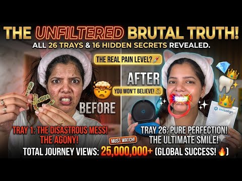 You Asked For It! My UNFILTERED Aligner Journey ✨ (Do They Actually Hurt?) #dbeautyblush