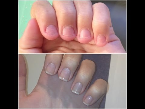 nail short beds nails biting bed wide grow acrylic french hansen sally quit cuticle stop bite care manicure contents triple