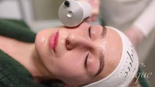 ENDOSPHERES FACE LIFT OBLIQUE BEAUTY HOUSE