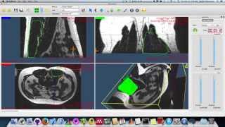 Clinical Software (FISICO - first version) screenshot 2