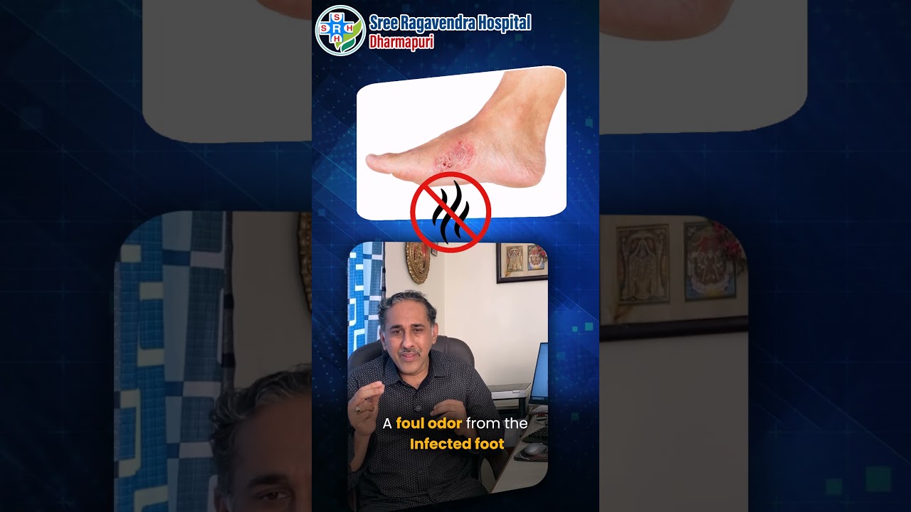 ⚠️ 𝐖𝐡𝐞𝐧 𝐃𝐢𝐚𝐛𝐞𝐭𝐢𝐜 𝐅𝐨𝐨𝐭 𝐔𝐥𝐜𝐞𝐫 𝐁𝐞𝐜𝐨𝐦𝐞𝐬 𝐃𝐚𝐧𝐠𝐞𝐫𝐨𝐮𝐬 | 𝐒𝐫𝐞𝐞 𝐑𝐚𝐠𝐚𝐯𝐞𝐧𝐝𝐫𝐚 𝐇𝐨𝐬𝐩𝐢𝐭𝐚𝐥 𝐃𝐡𝐚𝐫𝐦𝐚𝐩𝐮𝐫𝐢