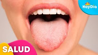 ¿Sabes qué dice tu lengua de tu salud? Un médico lo explica | Hoy Día | Telemundo ¿Sabes qué dice tu lengua de tu salud? Un médico lo explica | Hoy Día | Telemundo