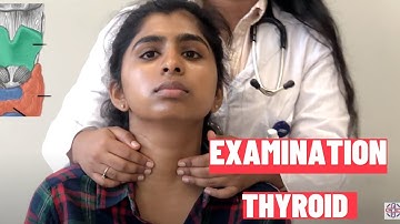 Clinical Examination of Thyroid Gland | OSCE Guide: Clinical skills