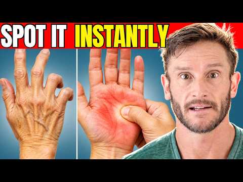 The Hand Characteristic that Means Insulin Resistance and Fatty Liver