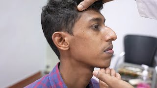 Facial Asymmetry Correction, Rhinoplasty - Pre Surgery Consultation