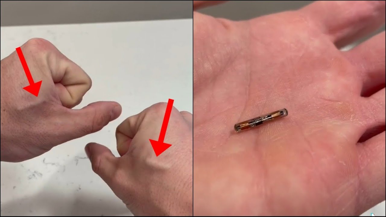 Hand Implant To Unlock your Door And Computer - YouTube