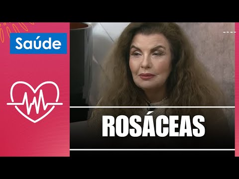 ROSÁCEAS tire suas dúvidas com a dermatologista Ligia Kogos – 13/09/24