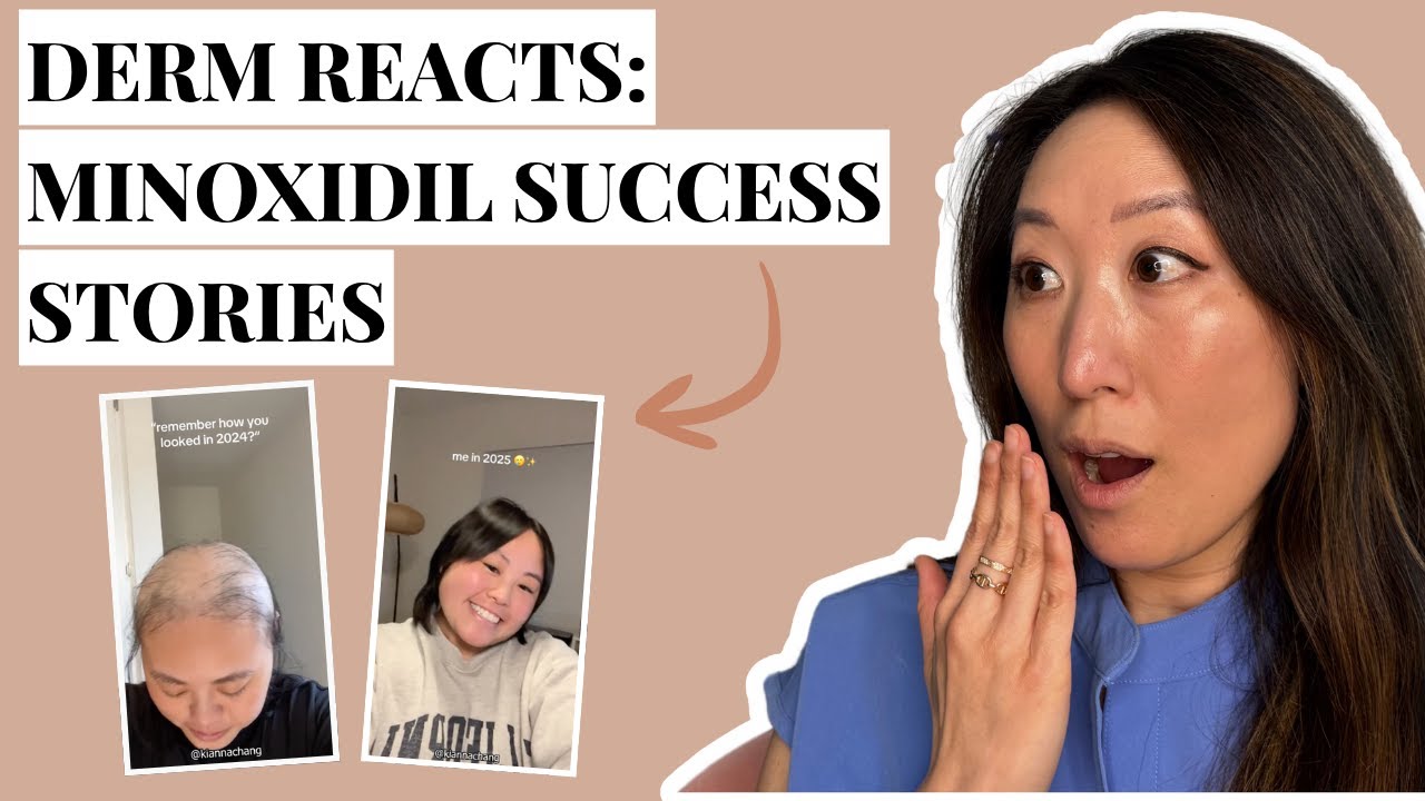 Derm Reacts to Viral Minoxidil Transformations (and Explains What’s Actually Happening)