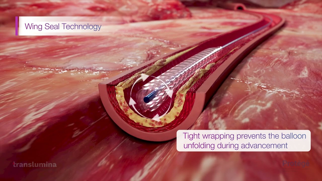 Protégé DEB Technology