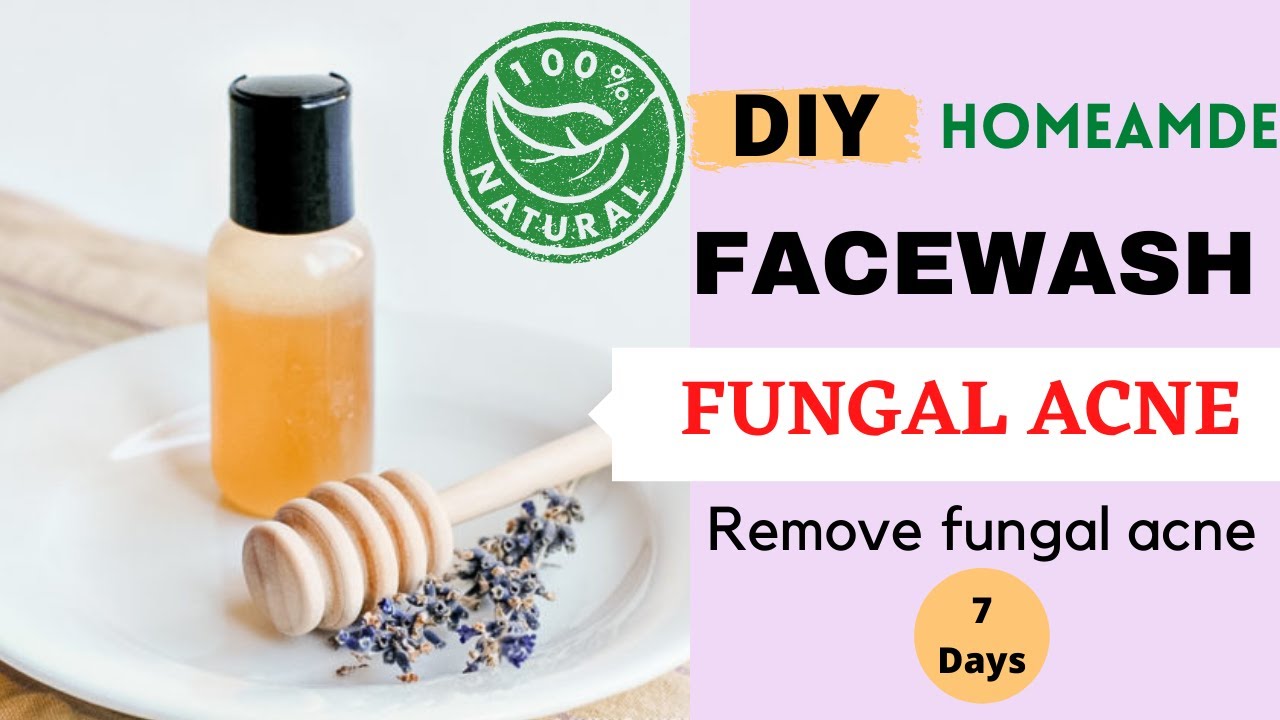 fungal acne face wash homemade face wash for fungal acne YouTube