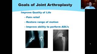 Whittier Health Network Presents: What are the Latest Technologies in Hip and Knee Replacements Details