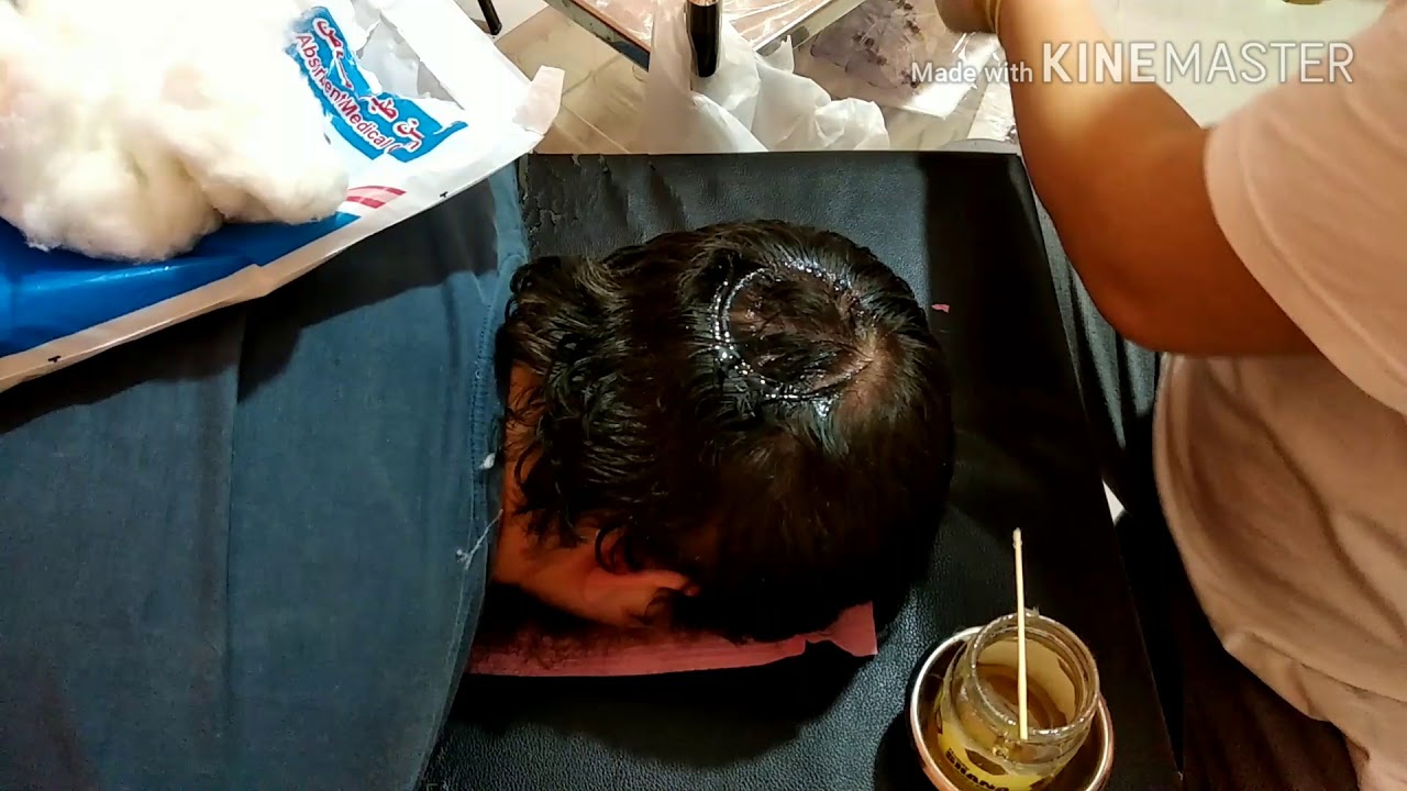 Мастер класс по хиджаме на голову с волосами