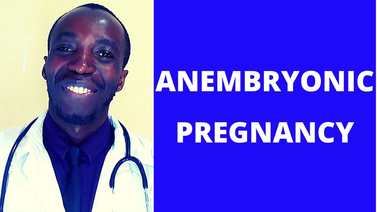 BLIGHTED OVUM Or ANEMBRYONIC PREGNANCY WHAT IS A BLIGHTED OVUM blighted-ovum-or-anembryonic-pregnancy-what-is-a-blighted-ovum