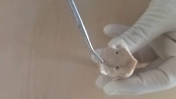 NEUROANATOMY - MIDBRAIN EXTERNAL FEATURES - BY DR MITESH DAVE