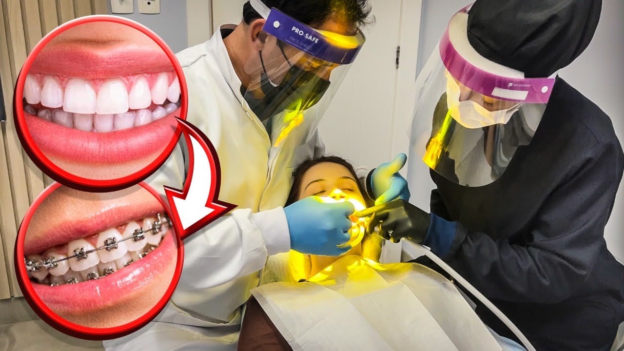 A NICOLLY TIROU O APARELHO!! - Finalmente…