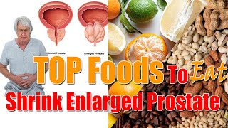 Top Foods to Eat Shrink Enlarged Prostate | Best #diet For #prostate enlargement