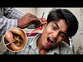 😳 You Won't Believe What Came Out of This Ear!🔥 | Extreme Ear Cleaning Transformation