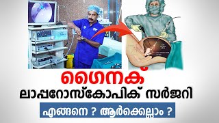 Gynaec Laparoscopic Surgery എങ്ങനെ ? ആർക്കെല്ലാം ചെയ്യാം ? Dr. Nazer | Arogyam