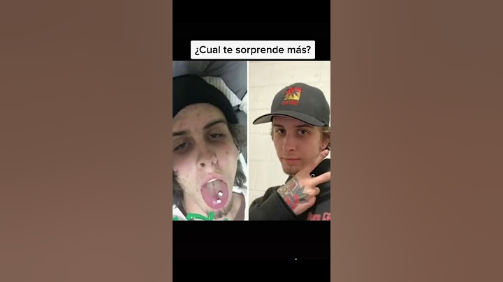Personas Antes Y Después De Consumir Cristal