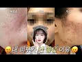 트러블 고민상담🕵🏻‍♀️ 피부타입별 트러블 스킨케어 루틴🌿 | 나에게 꼭 맞는 스킨케어 추천✨