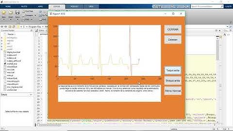 ECG Matlab