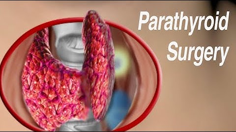 Parathyroid Surgery: Traditional Open and Minimally Invasive Approaches