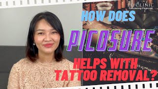 【How does Picosure helps with Tattoo Removal?】