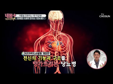겨울보다 여름이 더 위험한 『당뇨병』  [내 몸 플러스] 205회 202000712