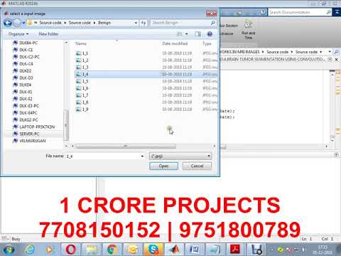 Brain Tumor Segmentation Using KNN in MRI Images - 1Crore Projects