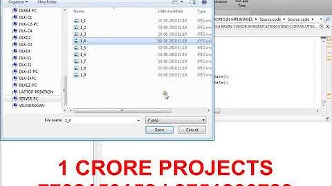 Brain Tumor Segmentation Using KNN in MRI Images - 1Crore Projects