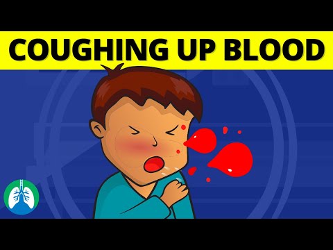 Video: Coughing Up Blood: What It Can Be And What To Do, Reasons, Video